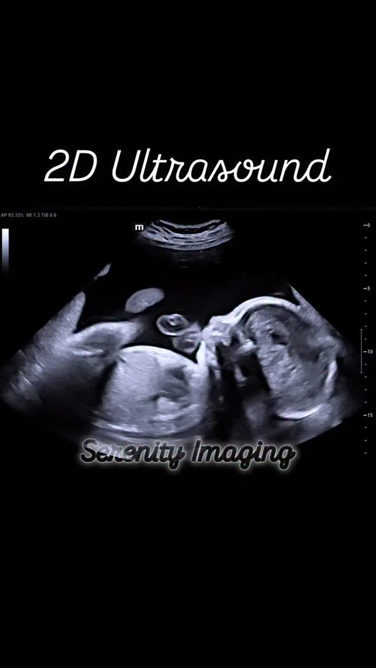sld4 ultrasound r1